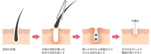 記事番号:129807/アイテムID:4671692の画像